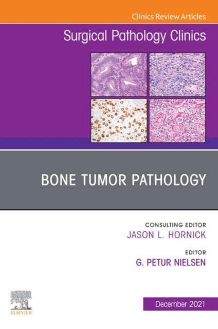 E-knjiga Bone Tumor Pathology, An Issue of Surgical Pathology Clinics Gunnlaugur Petur Nielsen