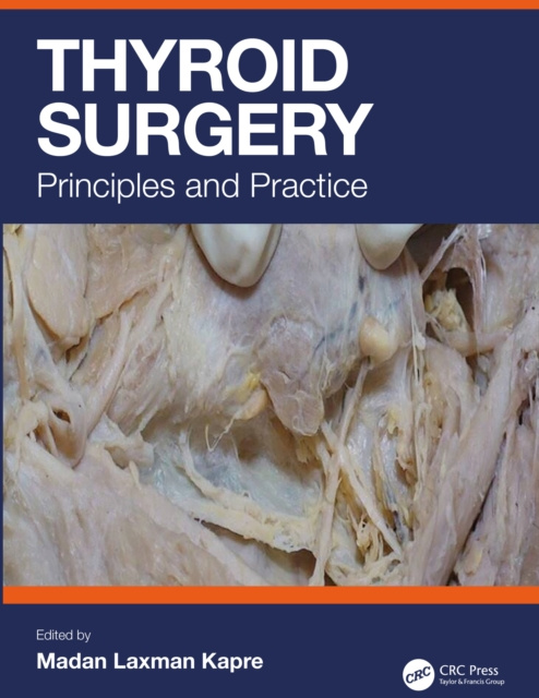 E-knjiga Thyroid Surgery Madan Laxman Kapre