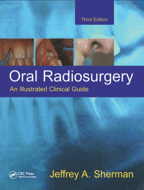 E-knjiga Oral Radiosurgery Jeffrey A. Sherman