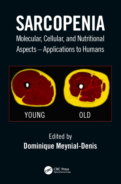 E-book Sarcopenia Dominique Meynial-Denis