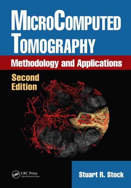 E-knjiga MicroComputed Tomography Stuart R. Stock
