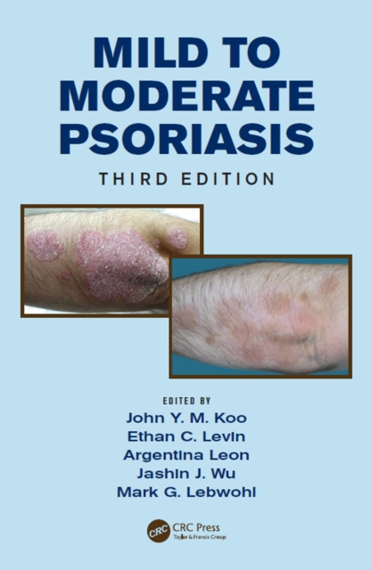 E-kniha Mild to Moderate Psoriasis John Koo
