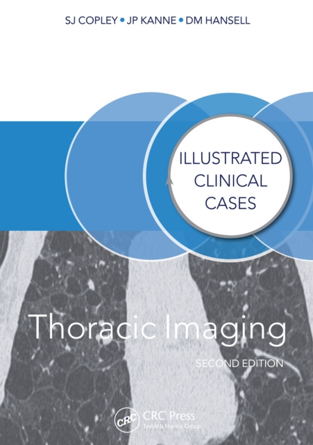 E-knjiga Thoracic Imaging Sue Copley