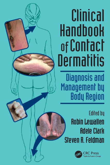 E-kniha Clinical Handbook of Contact Dermatitis Robin Lewallen