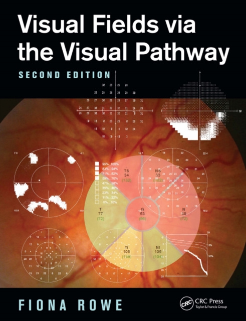 E-book Visual Fields via the Visual Pathway Fiona Rowe