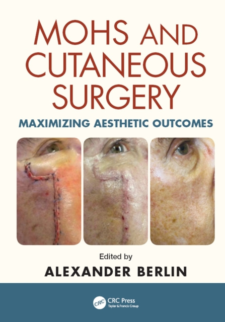 E-Book Mohs and Cutaneous Surgery Alexander Berlin