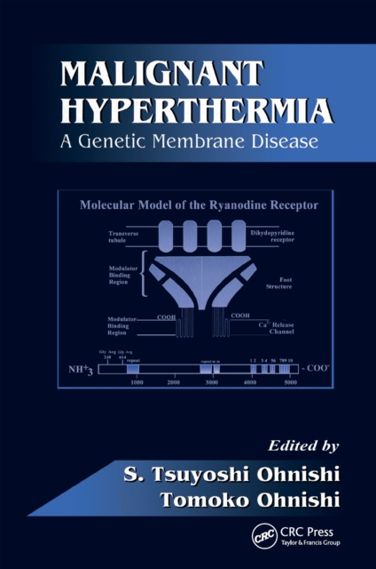 E-knjiga Malignant Hyperthermia S. Tsuyoshi Ohnishi