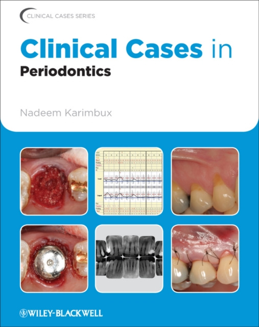E-knjiga Clinical Cases in Periodontics Nadeem Karimbux