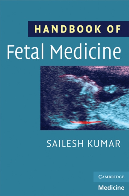 E-book Handbook of Fetal Medicine Sailesh Kumar