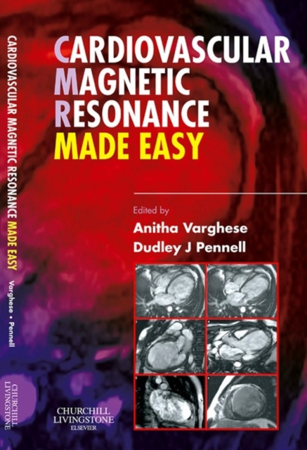 E-book Cardiovascular Magnetic Resonance Made Easy Anitha Varghese