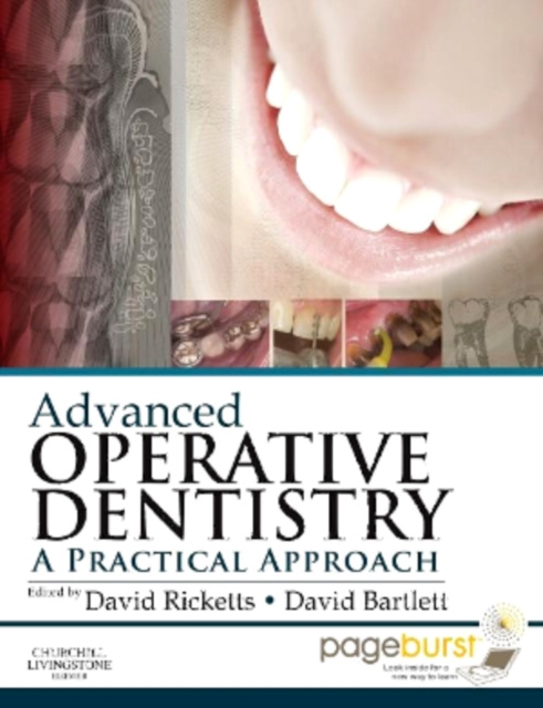 E-book Advanced Operative Dentistry David Ricketts
