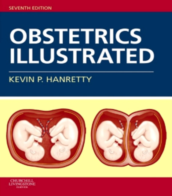 E-Book Obstetrics Illustrated E-Book Kevin P. Hanretty
