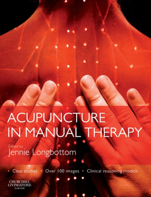 E-book Acupuncture in Manual Therapy Jennie Longbottom