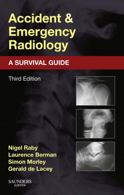 E-kniha Accident and Emergency Radiology: A Survival Guide Nigel Raby