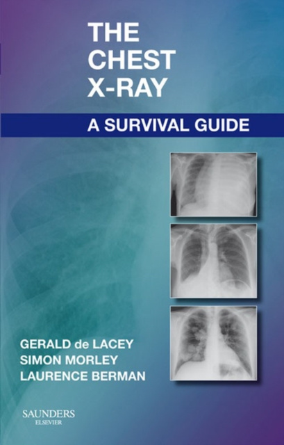 E-kniha Chest X-Ray: A Survival Guide Gerald de Lacey