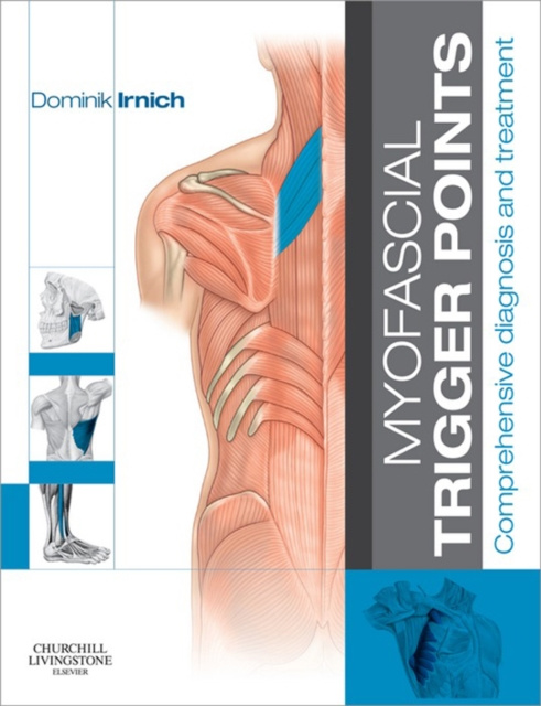 E-kniha Myofascial Trigger Points - E-Book Dominik Irnich