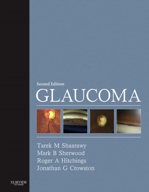 E-knjiga Glaucoma E-Book Tarek Shaarawy