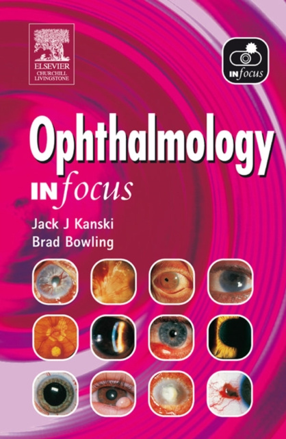E-kniha Ophthalmology In Focus Jack J. Kanski