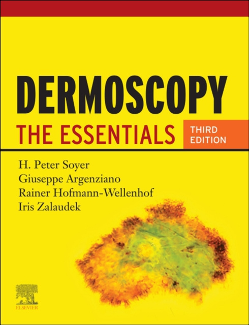 E-kniha Dermoscopy E-Book H. Peter Soyer
