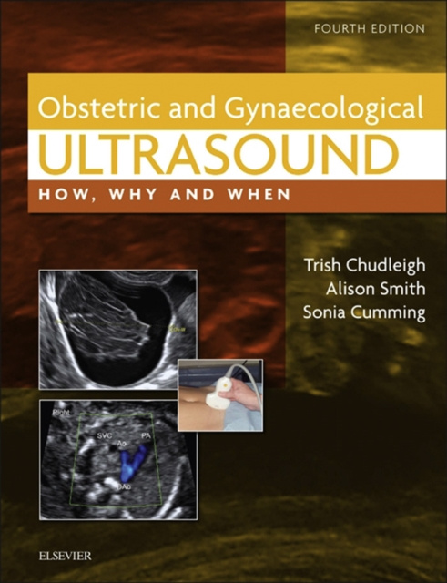 E-kniha Obstetric & Gynaecological Ultrasound Trish Chudleigh