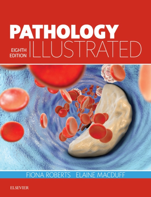 E-book Pathology Illustrated E-Book Fiona Roberts