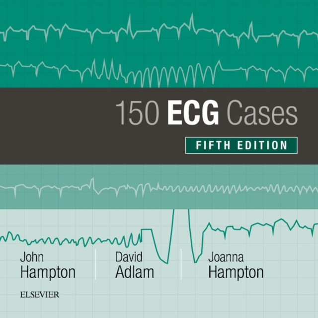 E-kniha 150 ECG Cases John Hampton