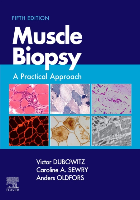 E-kniha Muscle Biopsy E-Book Victor Dubowitz