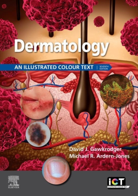 E-Book Dermatology E-Book David Gawkrodger