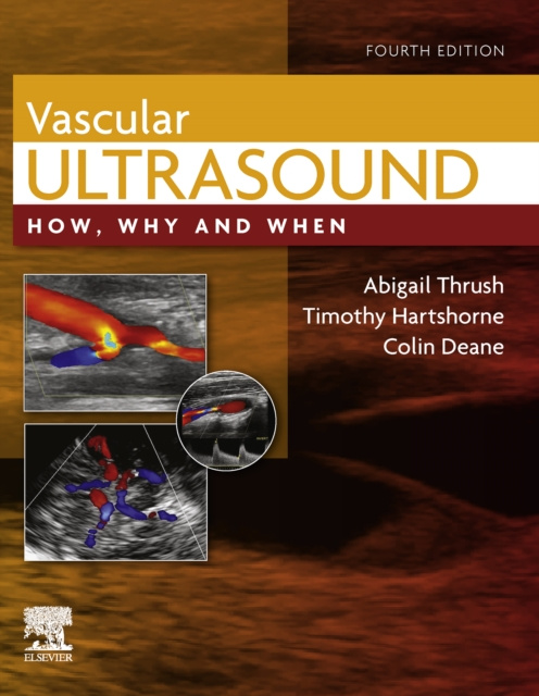 E-kniha Vascular Ultrasound E-Book Abigail Thrush