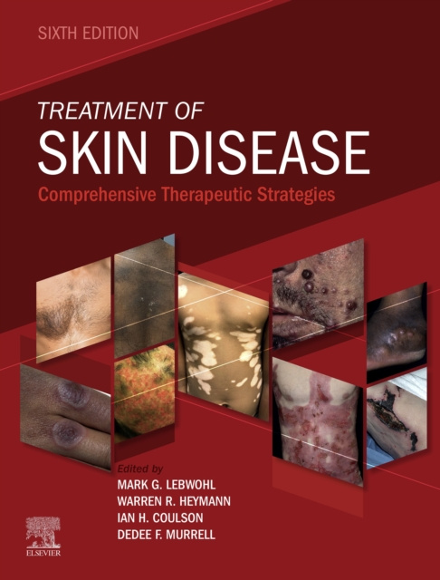 E-kniha SPEC - Treatment of Skin Disease, 6th Edition, 12-Month Access, eBook Mark G. Lebwohl