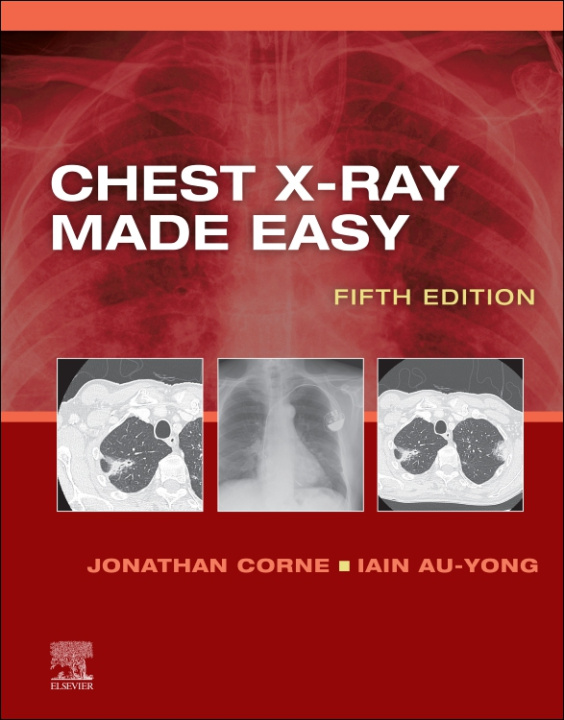 E-kniha Chest X-Ray Made Easy E-Book Jonathan Corne