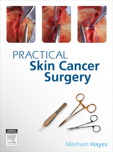 E-book Practical Skin Cancer Surgery MILEHAM HAYES