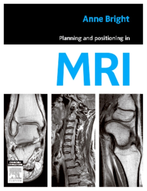 E-kniha Planning and Positioning in MRI - E-Book Anne Bright