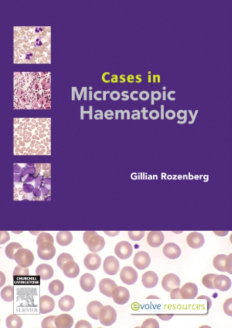 E-knjiga Cases in Microscopic Haematology - E-Book Gillian Rozenberg