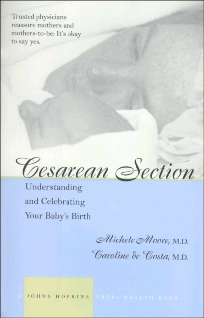 E-book Cesarean Section Michele C. Moore