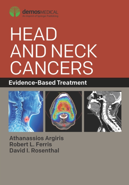 E-book Head and Neck Cancers Athanassios Argiris MD FACP