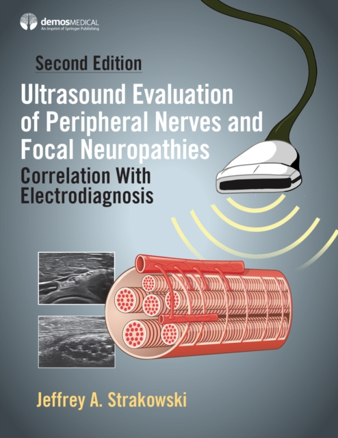 E-kniha Ultrasound Evaluation of Peripheral Nerves and Focal Neuropathies, Second Edition MD Jeffrey A. Strakowski