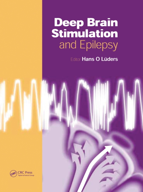 E-knjiga Deep Brain Stimulation and Epilepsy Hans O. Luders