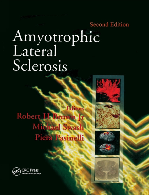 E-book Amyotrophic Lateral Sclerosis, Second Edition Robert H. Brown