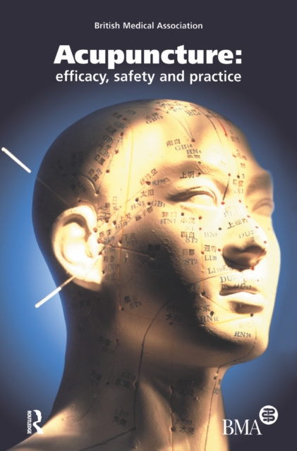 E-book Acupuncture British Medical Association