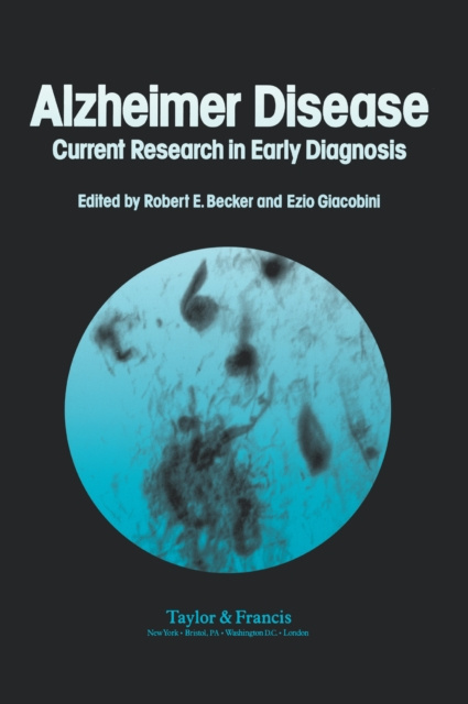 E-kniha Alzheimer's Disease Robert Becker