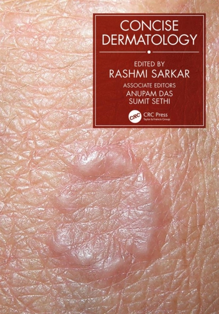 E-knjiga Concise Dermatology Rashmi Sarkar