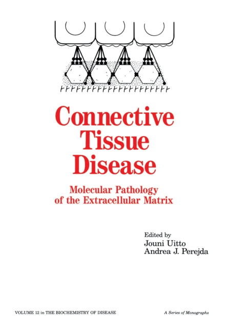 E-knjiga Connective Tissue Disease Jouni Uitto