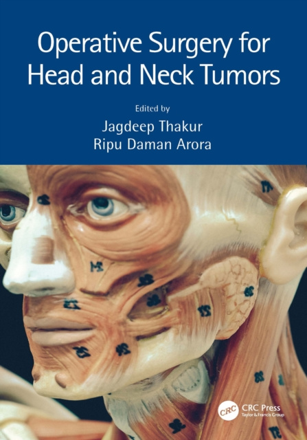 E-kniha Operative Surgery for Head and Neck Tumors Jagdeep Thakur