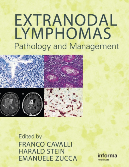 E-book Extranodal Lymphomas Franco Cavalli