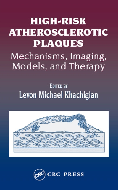 E-Book High-Risk Atherosclerotic Plaques Levon Michael Khachigian