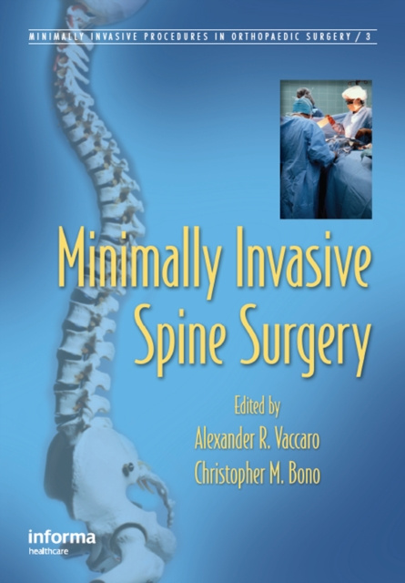 E-book Minimally Invasive Spine Surgery Alexander R. Vaccaro