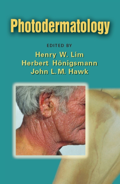 E-kniha Photodermatology Henry W. Lim