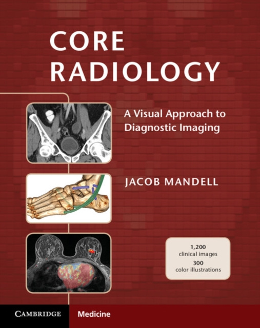 ebook Core Radiology Jacob Mandell