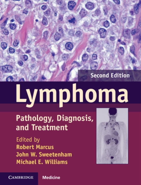 E-knjiga Lymphoma Robert Marcus